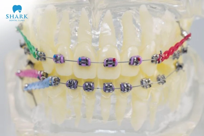 Chun chuỗi theo màu