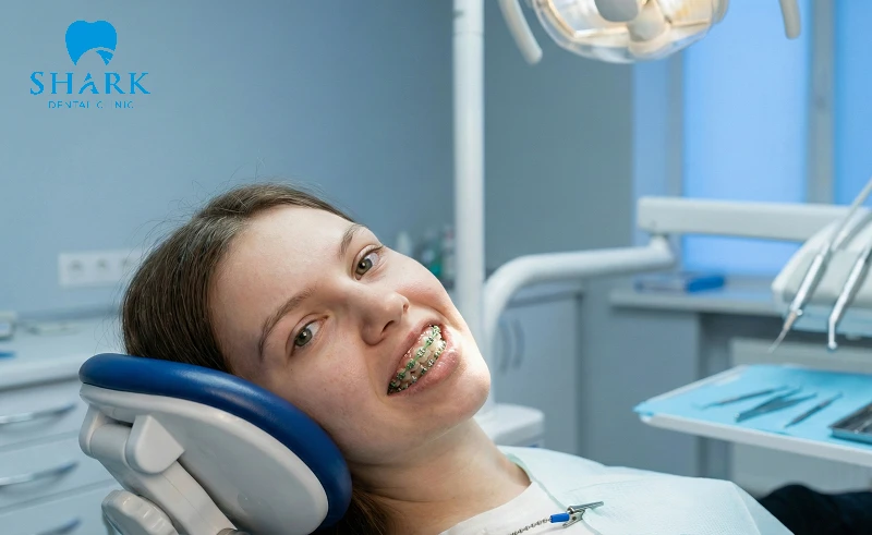 Đeo chun chuỗi bạn cần tái khám thường xuyên để duy trì lực kéo phù hợp