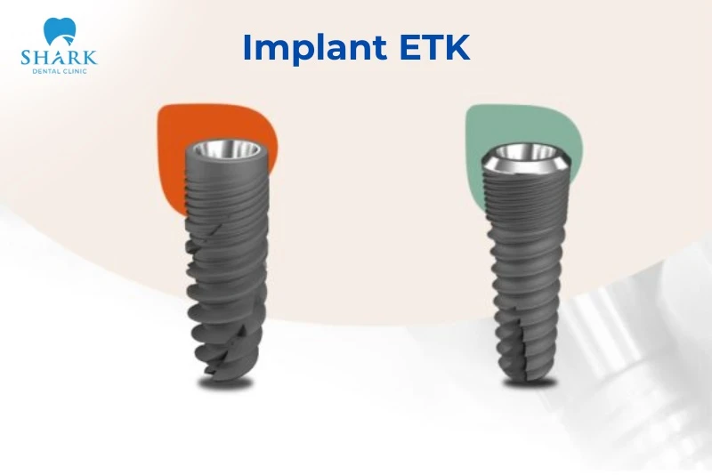 Trụ Implant ETK có nguồn gốc xuất xứ từ đâu? Có tốt không? 9 Trụ Implant ETK có xuất xứ từ Pháp