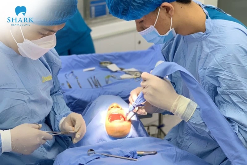 Trụ Implant MIS là gì? Có xuất xứ từ nước nào? 15 Nha khoa Shark là địa chỉ tốt nhất để khách hàng tân trang nụ cười