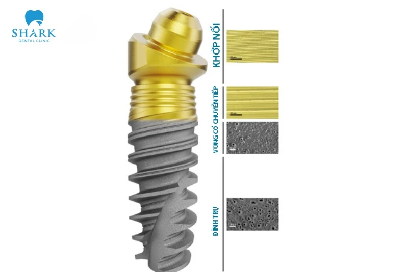 Cấu tạo Implant Nobel