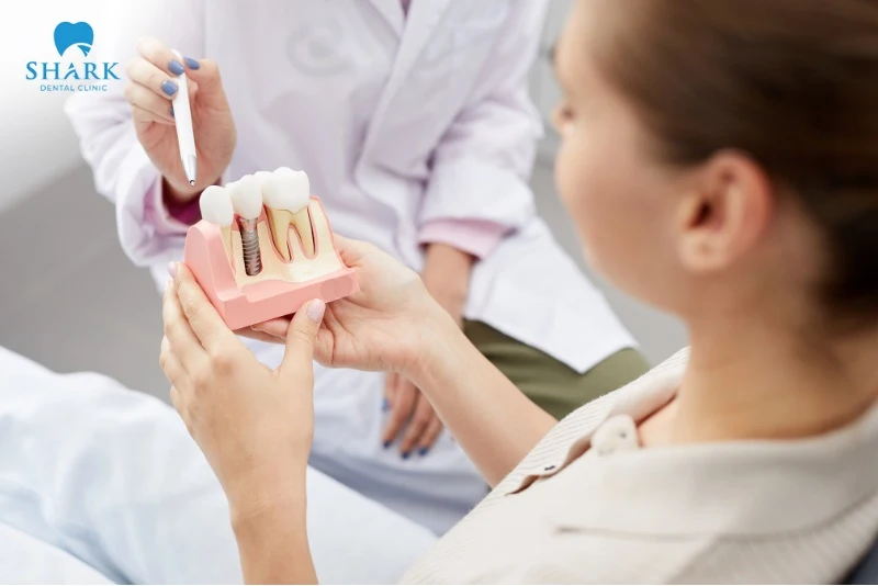 Bác sĩ tư vấn kỹ lượng về loại trụ trước khi cấy Implant