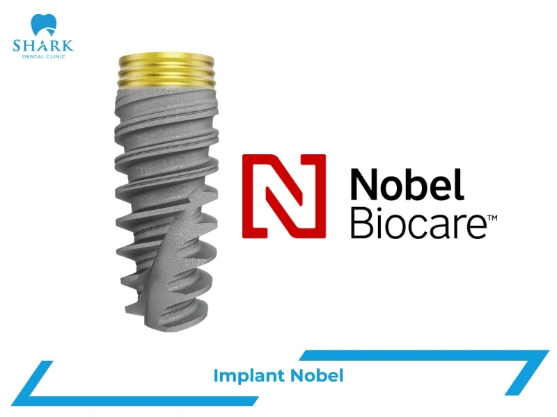 Trụ Implant Nobel của nước nào? Có giá bao nhiêu tiền? 51 Trụ Implant Nobel