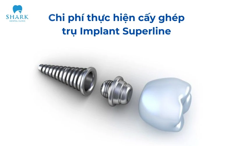 Khớp nối Abutment