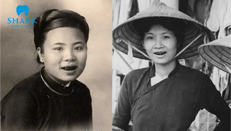 Phụ nữ nhuộm răng đen được coi là cái đẹp thời xưa