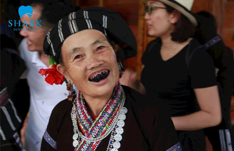 Răng đen giúp bảo vệ sức khỏe răng miệng tốt