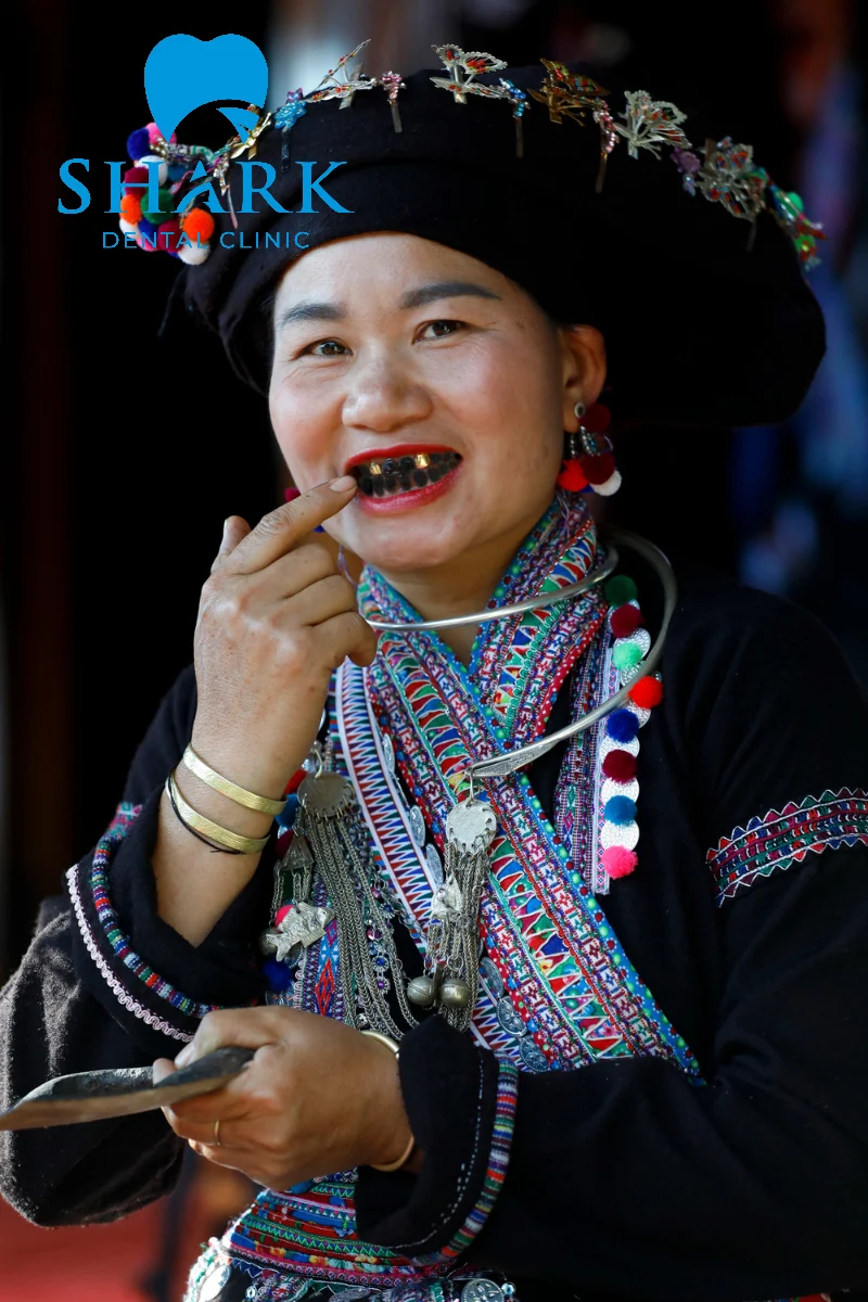 Dân tộc Thái thường nhuộm màu răng để phù hợp với văn hóa vùng miền