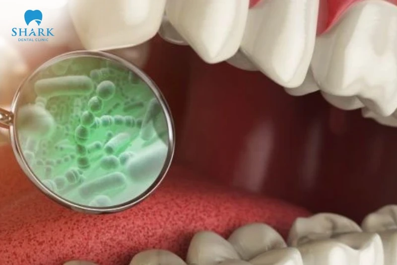 Nước súc miệng Chlorhexidine là gì? Có tác dụng gì? 9 Chlorhexidine có khả năng kháng khuẩn tốt