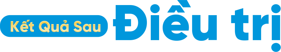 Kết quả sau điều trị