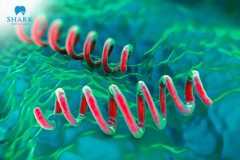 Di truyền do bệnh giang mai là yếu tố dẫn đến răng Hutchinson