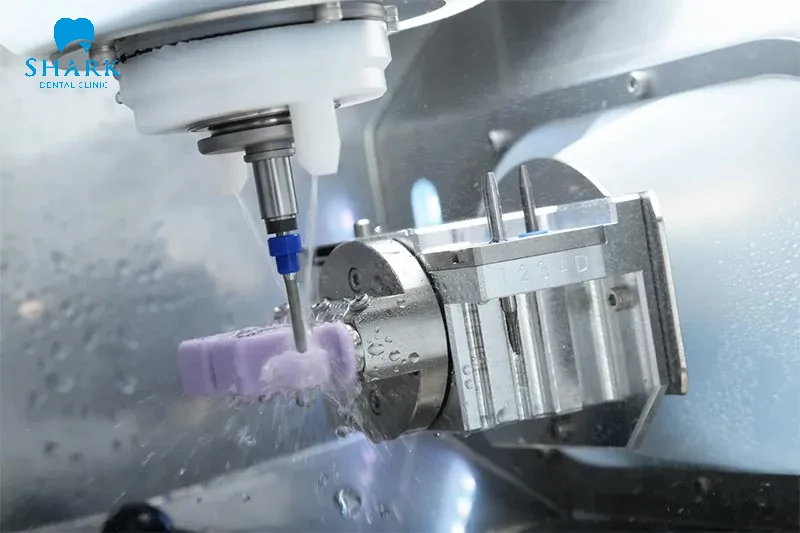 Chế tác răng sứ Roland tại phòng LAB với công nghệ hiện đại