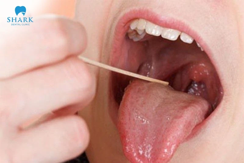 Cách kiểm tra vòng họng ở nhà an toàn