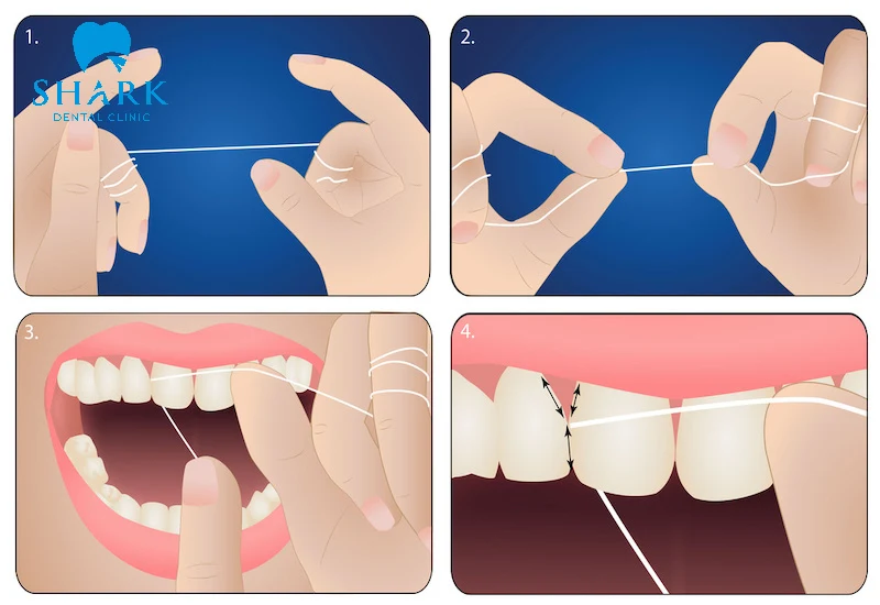Sử dụng chỉ nha khoa đúng chuẩn
