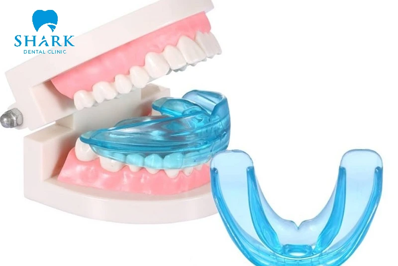 Hàm tiền chỉnh nha: Giải pháp vàng giúp nắn chỉnh răng cho bé 11 Hình ảnh hàm Trainer Juniors