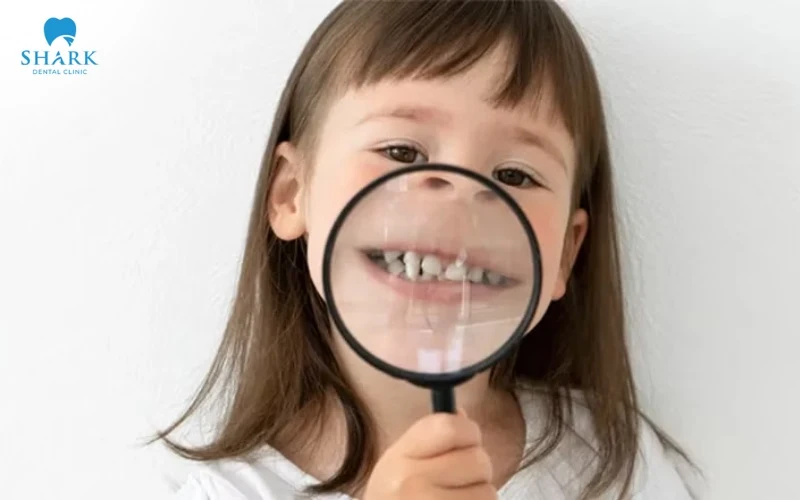 Bú bình lâu ngày sẽ bị hô