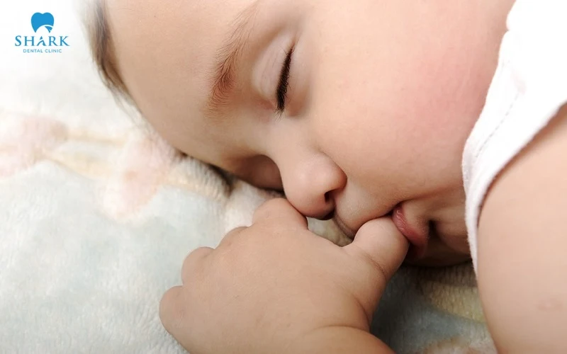 Thói quen mút ngón tay dễ khiến trẻ bị hô