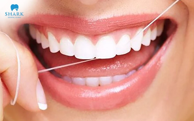 Dùng chỉ nha khoa để loại bỏ sạch mảng bám kẽ răng hơn