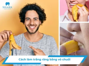 Cách làm trắng răng bằng vỏ chuối