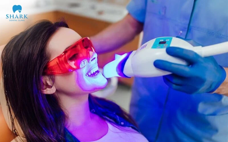 2 cách làm trắng răng với bánh mì hiệu quả và an toàn tại nhà 12 Tẩy trắng răng bằng Laser an toàn