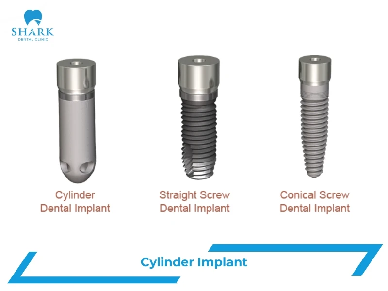 Cylinder Implant