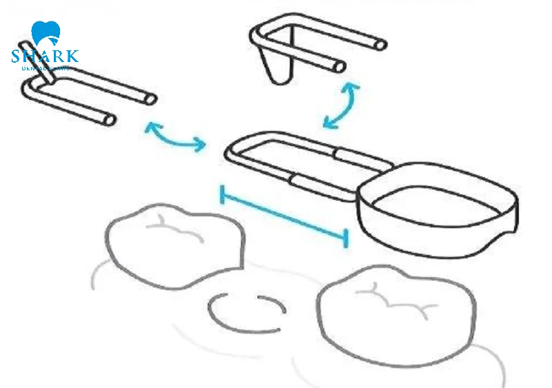Hàm neo chặn phía xa