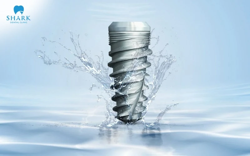 Chất liệu Titanium có tính tương thích sinh học cao