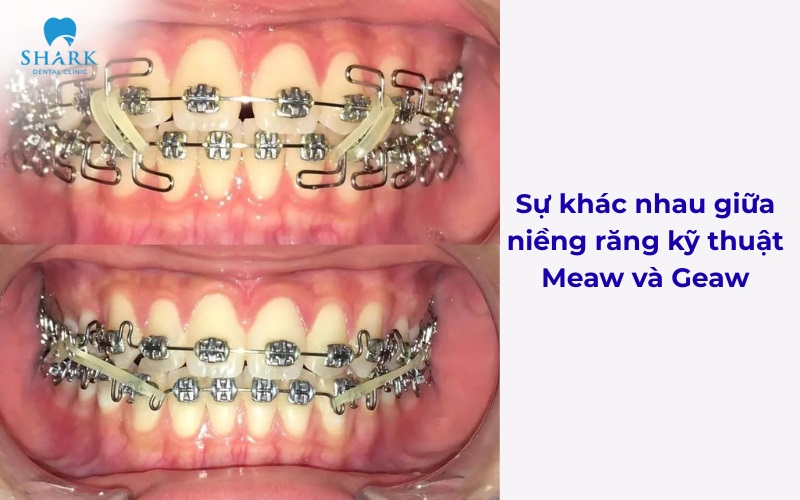 Sự khác biệt giữa Meaw và Geaw