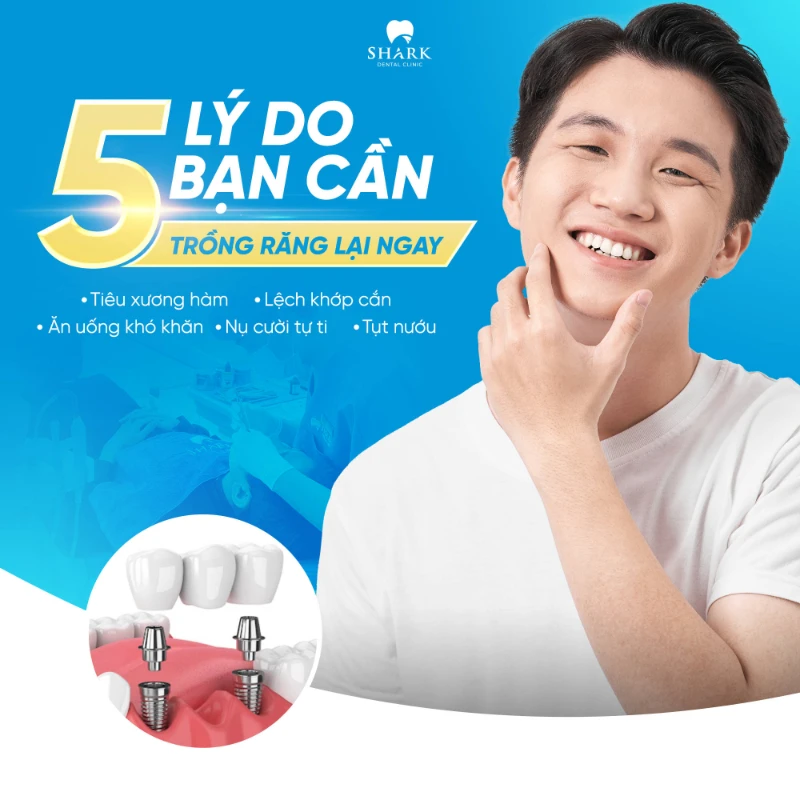 Lợi ích khi cấy Implant