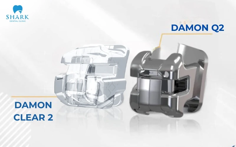 Mắc cài Damon Q2 và Damon Clear 2