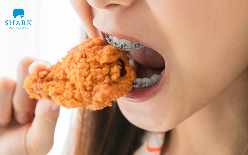 Niềng răng ăn cháo bao lâu? Bao lâu thì ăn cơm bình thường? 13 Tránh các thực phẩm quá cứng khi chỉnh nha