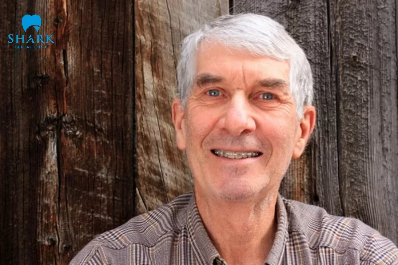 Người 50 tuổi có niềng răng được không? Cần lưu ý gì? 8 50 tuổi niềng răng giúp khắc phục hiệu quả các sai lệch khớp cắn nhưng mất thời gian lâu hơn