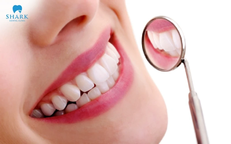 Bọc sứ thẩm mỹ có thể đem đến hiệu quả đối với tình trạng lệch nhân trung nhẹ