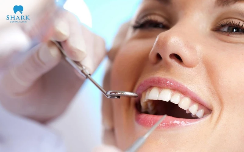 Răng sứ Multilayer Everest Speed là gì? Giá bao nhiêu tiền? 8 Phục hinh sứ Multilayer Everest Speed được chỉ định với nhiều trường hợp răng xấu