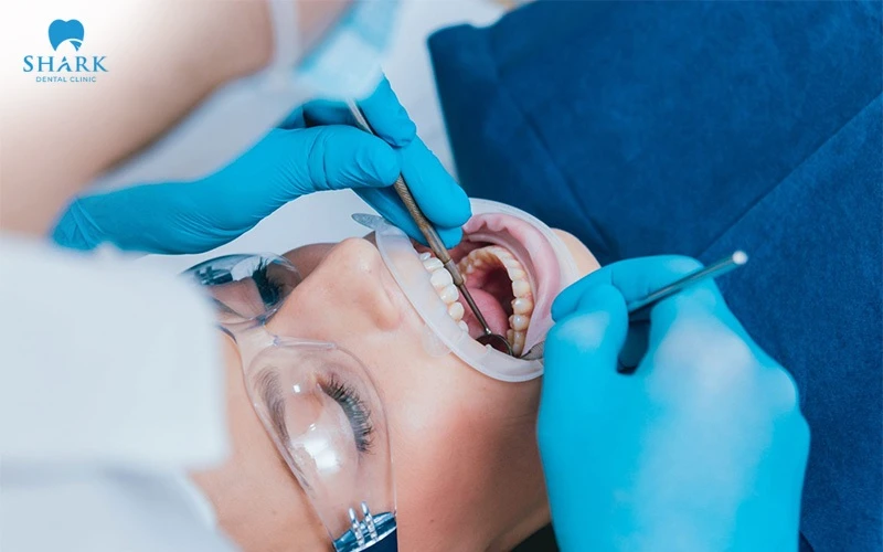 Công nghệ thổi cát cần đảm bảo được thực hiện trong môi trường vô trùng, chuẩn y khoa