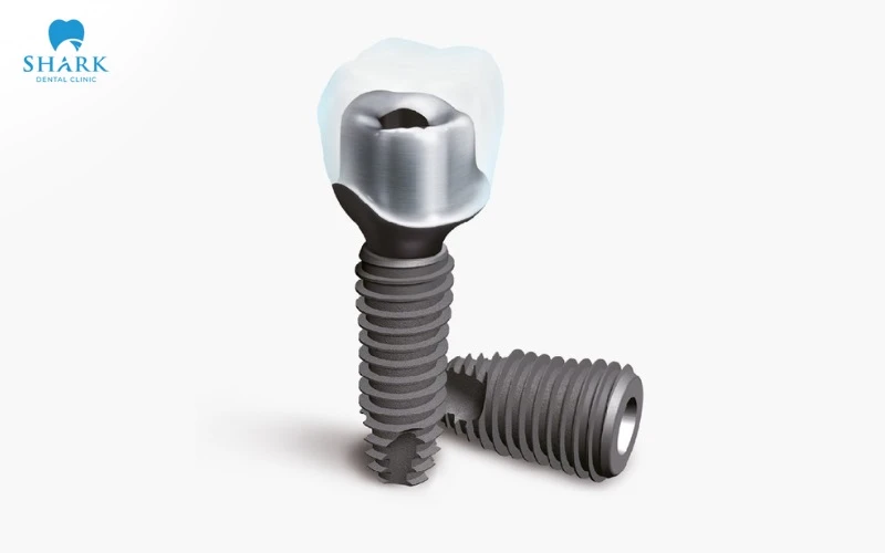 Trụ Implant Otex có mức chi phí rẻ và không đảm bảo chất lượng