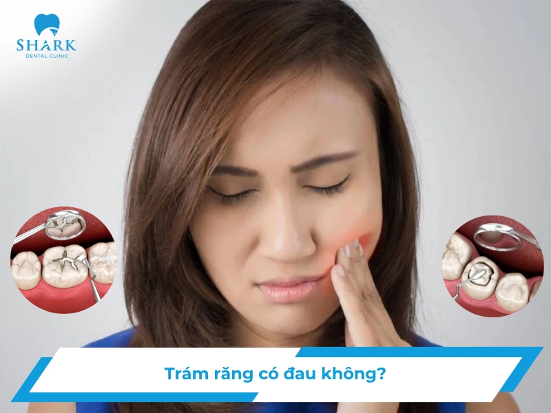 Trám răng có đau không?