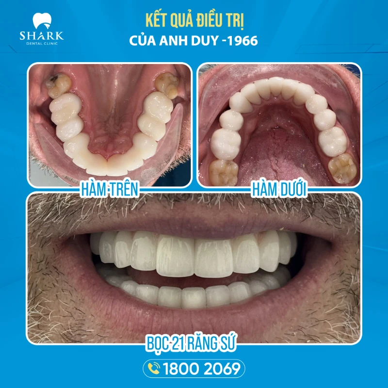 Hình ảnh sau khi điều trị