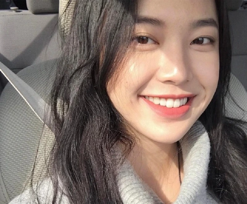 Chị Lam cạo vôi răng