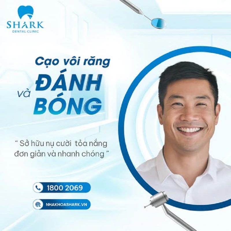 Anh Thanh cạo vôi răng