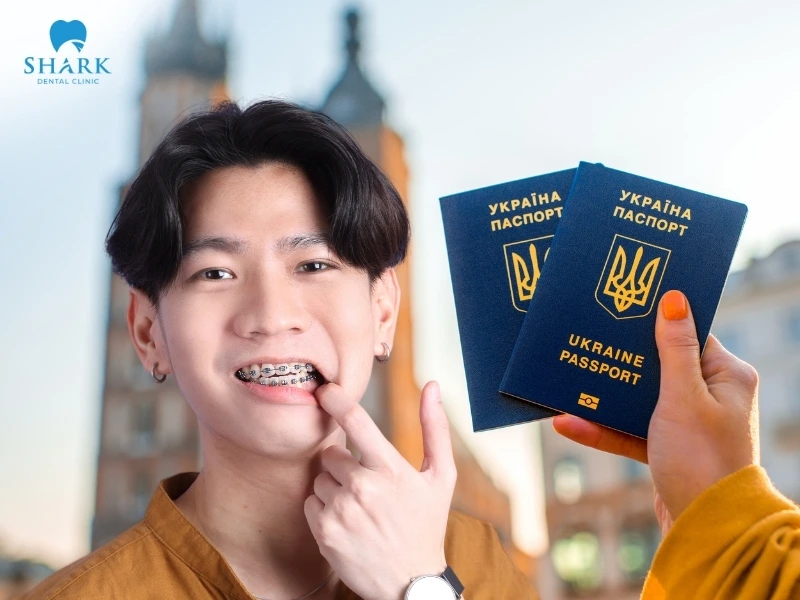 Du học sinh niềng răng mắc cài thì nên chọn loại mắc cài tự động