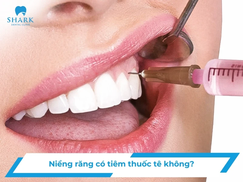 Niềng răng có tiêm thuốc tê không