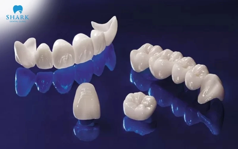 Răng sứ Cercon HT có tốt không? Giá bọc răng sứ Cercon HT 10 Lõi sườn Zirconia và men Ceram Kiss phủ bên ngoài