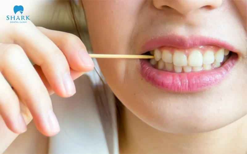 Không nên dùng tăm xỉa răng tại vị trí vừa trám, vì có thể làm bong hoặc nứt vỡ miếng trám