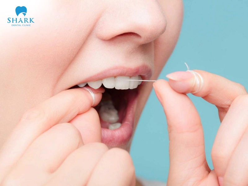 Chỉ nha khoa hỗ trợ làm sạch các mảng thức ăn bám ở răng