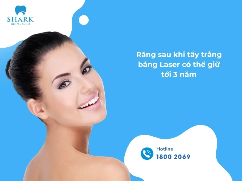Răng khi tẩy tại nha khoa uy tín có thể duy trì độ sáng đến 3 năm