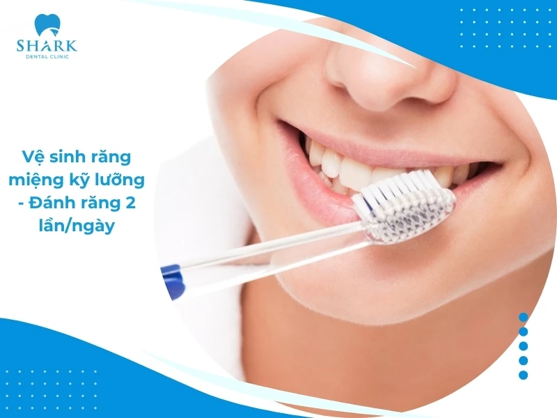Vệ sinh răng miệng kỹ lưỡng theo chỉ định từ bác sĩ để răng luôn sạch và trắng sáng