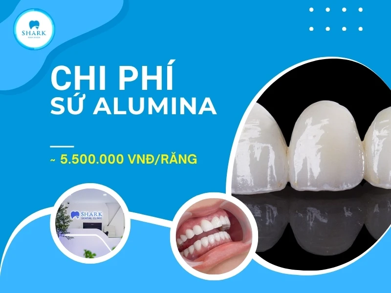 Chi phí thực hiện răng sứ Alumina thường chênh lệch khác nhau giữa các cơ sở