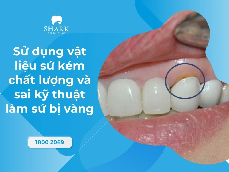 Vật liệu sứ kém chất lượng dễ xuống màu
