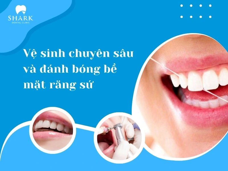 Đánh bóng lại bề mặt răng sứ