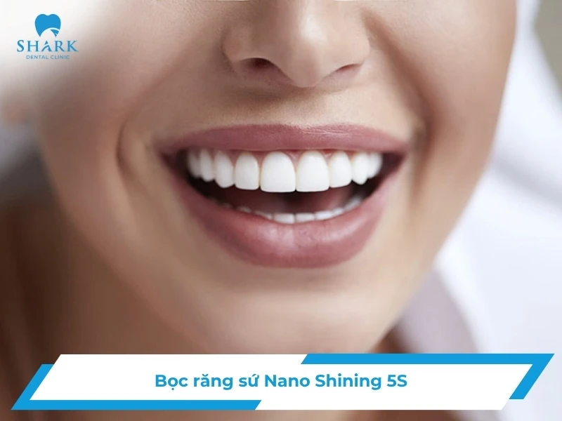 Bọc răng sứ Nano Shining 5S là gì? Loại sứ này có tốt không?